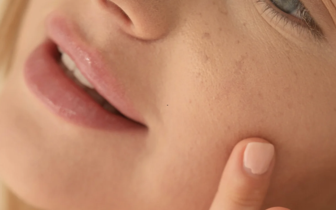 Dermal Filler Appointment in Chevy Chase, Maryland